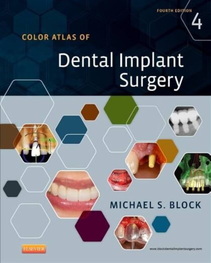 Color Atlas of Dental Implant Surgery 4th Edition
