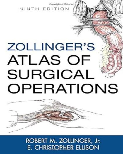 Zollinger's Atlas of Surgical Operations, Ninth Edition (Zollinger, Zollinger's Atlas of Surgical Operations Zollinge) by Jr., Robert M. Zollinger