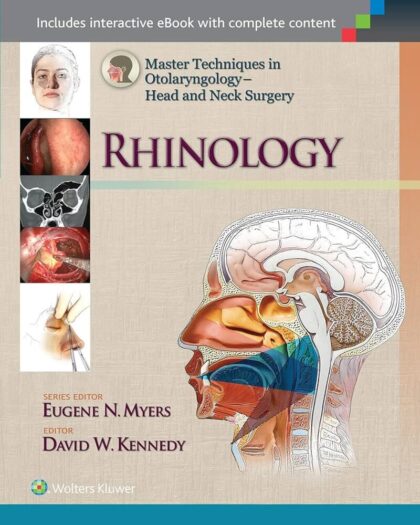 Master Techniques in Otolaryngology - Head and Neck Surgery: Rhinology