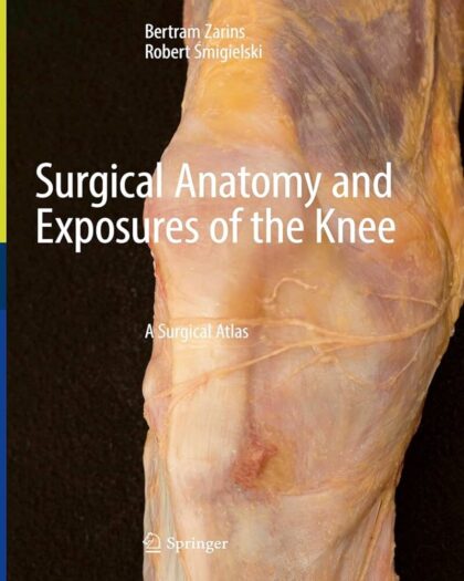Surgical Anatomy and Exposures of the Knee: A Surgical Atlas