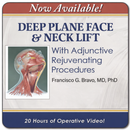 Deep Plane Face Lift & Neck Contouring: Full Operative Series