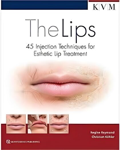 The Lips: 45 Injection Techniques for Esthetic Lip Treatment (Aesthetic Methods for Skin Rejuvination) 1st Edition