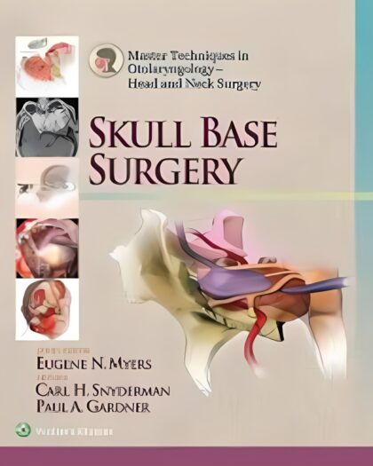 Master Techniques in Otolaryngology - Head and Neck Surgery: Skull Base Surgery Illustrated Edition, Kindle Edition