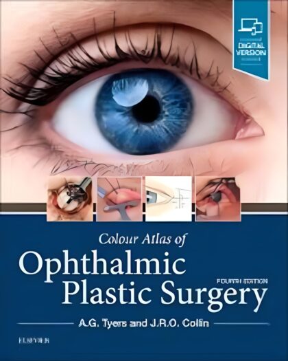 Colour atlas of ophthalmic plastic surgery