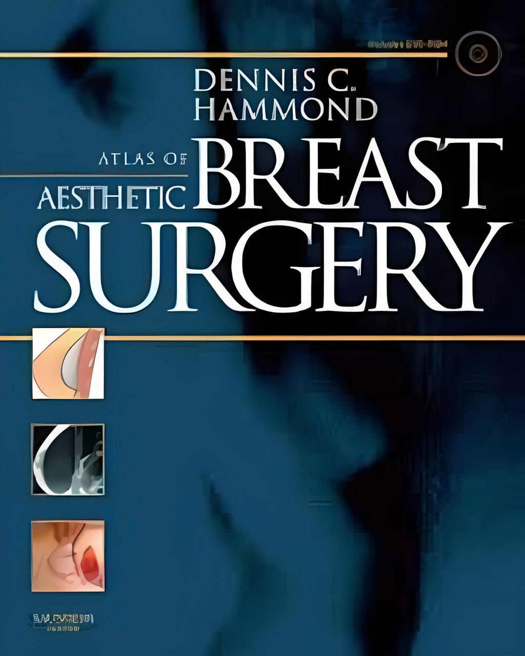 Atlas of Aesthetic Breast Surgery