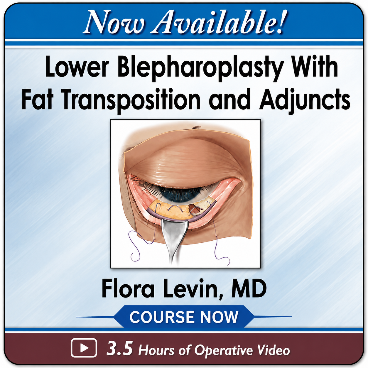 NATURAL LOWER EYELID REJUVENATION MASTERCLASS Advanced Fat Transposition Techniques for Smooth Lid–Cheek Transitions